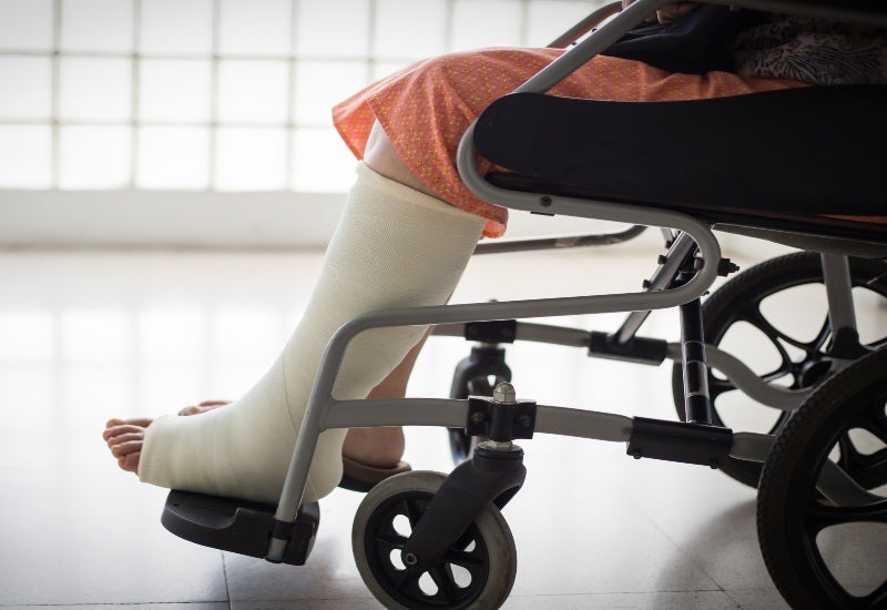 Patient is using a wheelchair with a leg cast for lower extremity injuries during recovery.